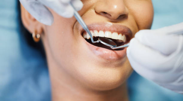 Best Emergency Treatment for Dental Infections or Abscesses in Smiths Station, AL